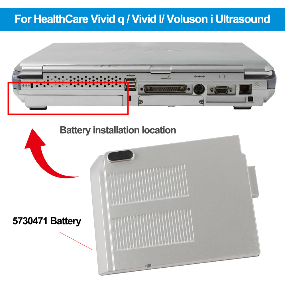 How to Calibrate the Battery on Your Vivid-q / Vivid-i Portable Ultrasound System